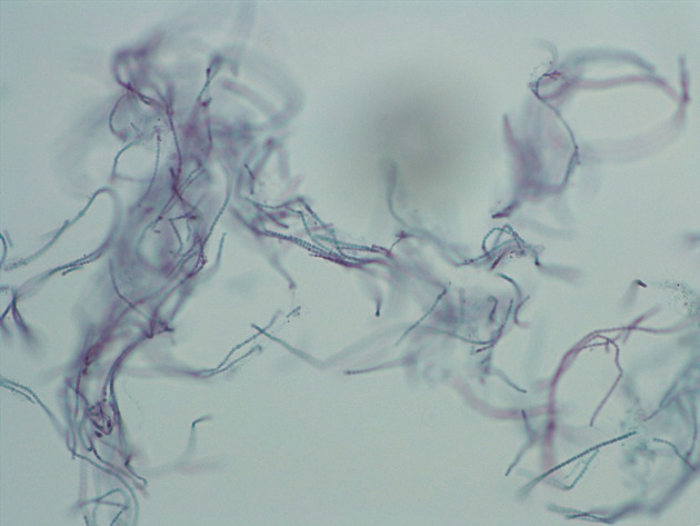 Anabaena Slides - Anabaena 06 200X